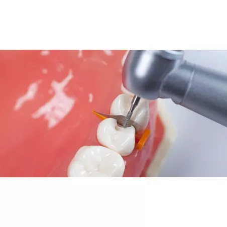 Kliny Fender Wedge Directa