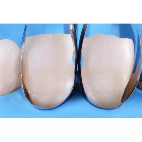 Unica paski metalowe do zębów przednich