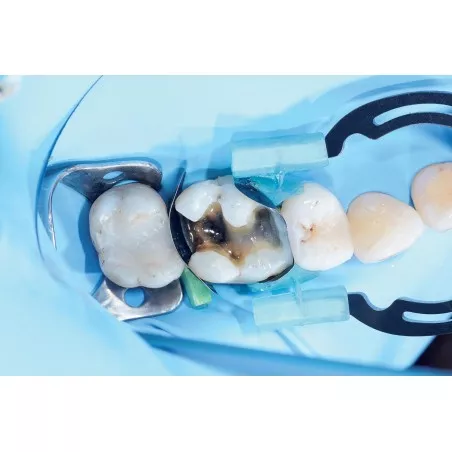 MyTines-zaciski do MyClip i MyRing Forte op. 6 par Polydentia