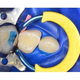 MyJunior Kit 6330 zestaw Polydentia